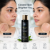 pigmentation pimpels jhaiyyan
