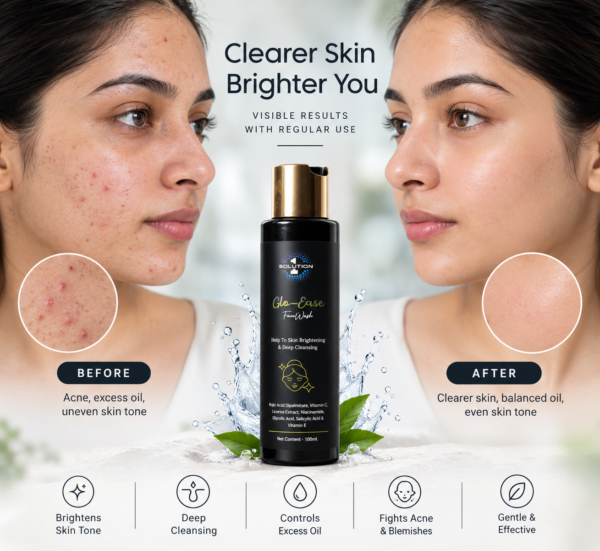 pigmentation pimpels jhaiyyan